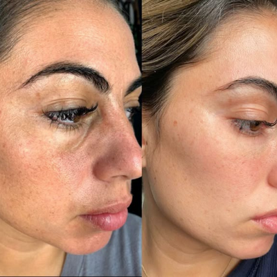 Revela Skin Pads